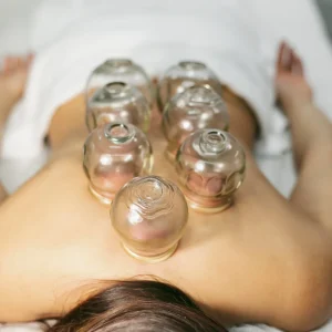 Cupping and massage therapy in Glasgow